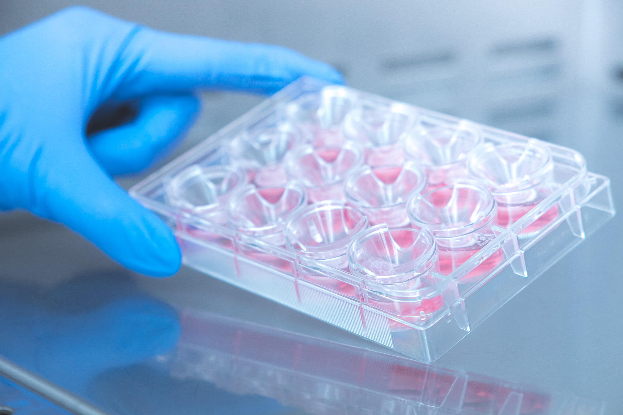 Epitalon Powder In Vitro Study | Shaanxi BLOOM Tech Co., Ltd Epitalon Powder In Vitro Study | Shaanxi BLOOM Tech Co., Ltd